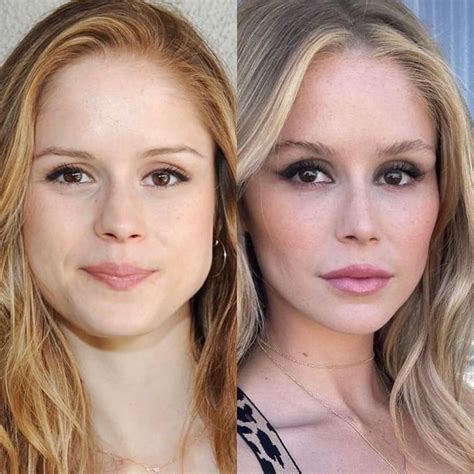 erin moriarty before surgery|Plastic surgeon reveals procedures Erin Moriarty has had